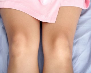 Воспаление околосуставных тканей коленного сустава или периартрит