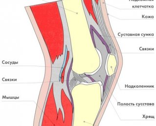 Воспаление связок в коленном суставе