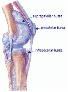 Виды бурситов коленного сустава