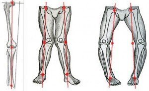 Схема ДОА коленного сустава