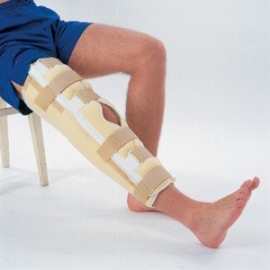 Гипсовая повязка для лечения разрыва связок коленного сустава