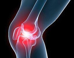 артрит колена